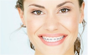 Diş teli taktırmadan önce bilmeniz gerekenler, Diş teli kullanırken dikkat edilmesi gerekenler