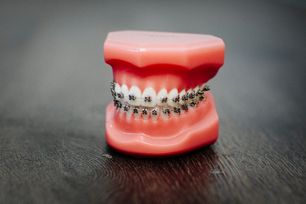 Diş Teli Tedavisinde Yasaklar