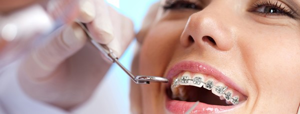 Ortodonti Tedavi Aşamaları